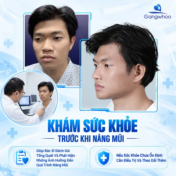 Những Trường Hợp Không Được Nâng Mũi? Các Bệnh Cần Lưu Ý Trước Khi Thẩm Mỹ