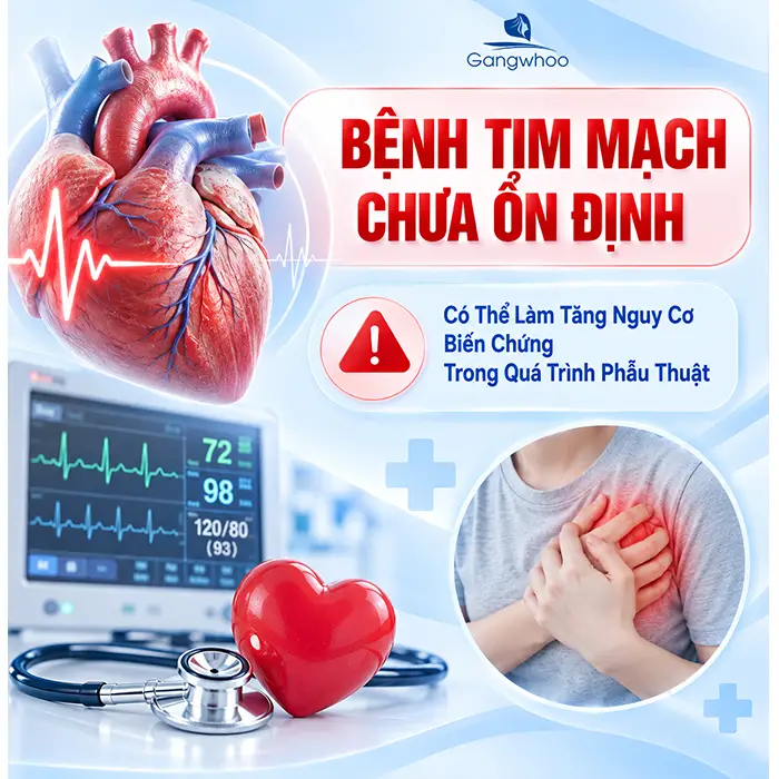 Những Trường Hợp Không Được Nâng Mũi? Các Bệnh Cần Lưu Ý Trước Khi Thẩm Mỹ