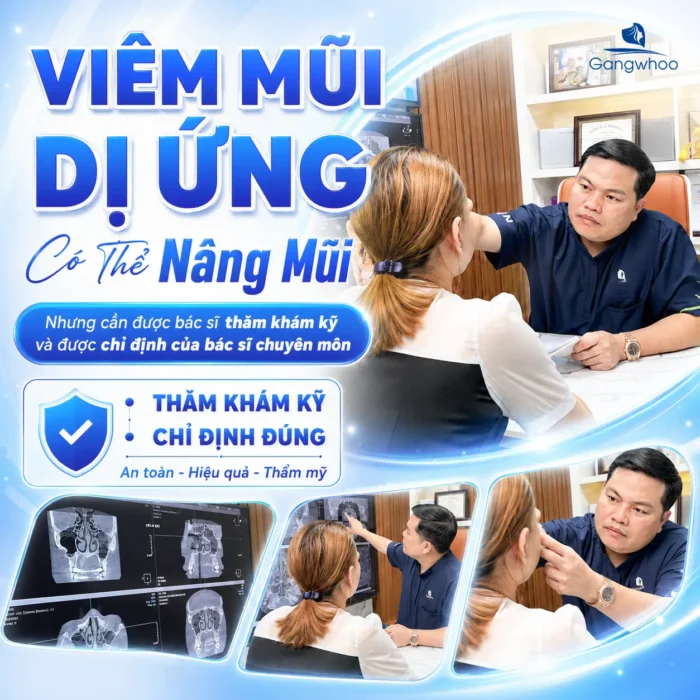 Viêm Mũi Dị Ứng Có Nên Nâng Mũi Không? Người Bị Viêm Xoang Cần Lưu Ý Gì?