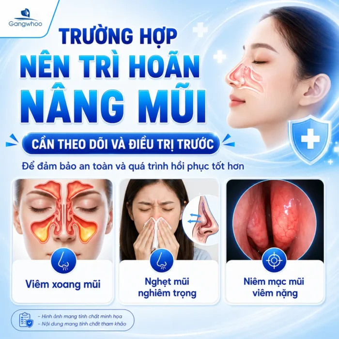 Viêm Mũi Dị Ứng Có Nên Nâng Mũi Không? Người Bị Viêm Xoang Cần Lưu Ý Gì?