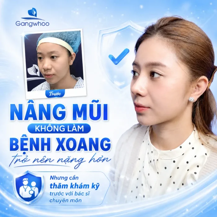 Viêm Mũi Dị Ứng Có Nên Nâng Mũi Không? Người Bị Viêm Xoang Cần Lưu Ý Gì?