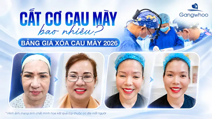 Cắt Cơ Cau Mày Giá Bao Nhiêu? Bảng Giá Năm 2026