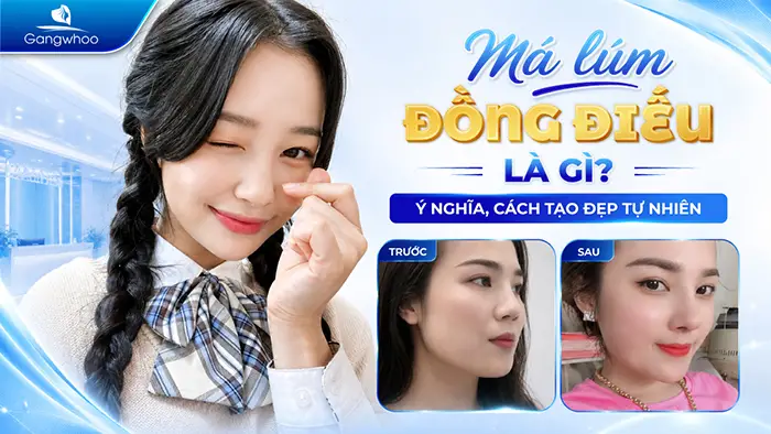 Má Lúm Đồng Điếu Là Gì? Ý Nghĩa Tướng Số Và Cách Sở Hữu Nụ Cười Duyên