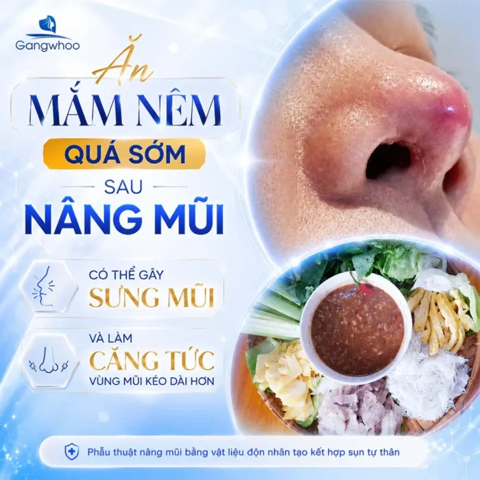 Sau Khi Nâng Mũi Ăn Mắm Nêm Được Không? Bao Lâu Được Ăn Lại?