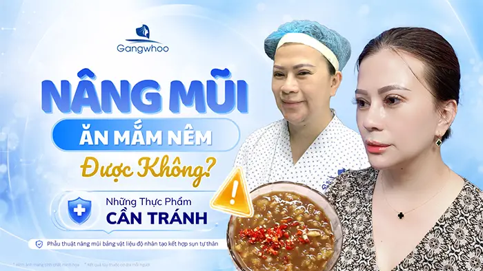 Sau Khi Nâng Mũi Ăn Mắm Nêm Được Không? Bao Lâu Được Ăn Lại?