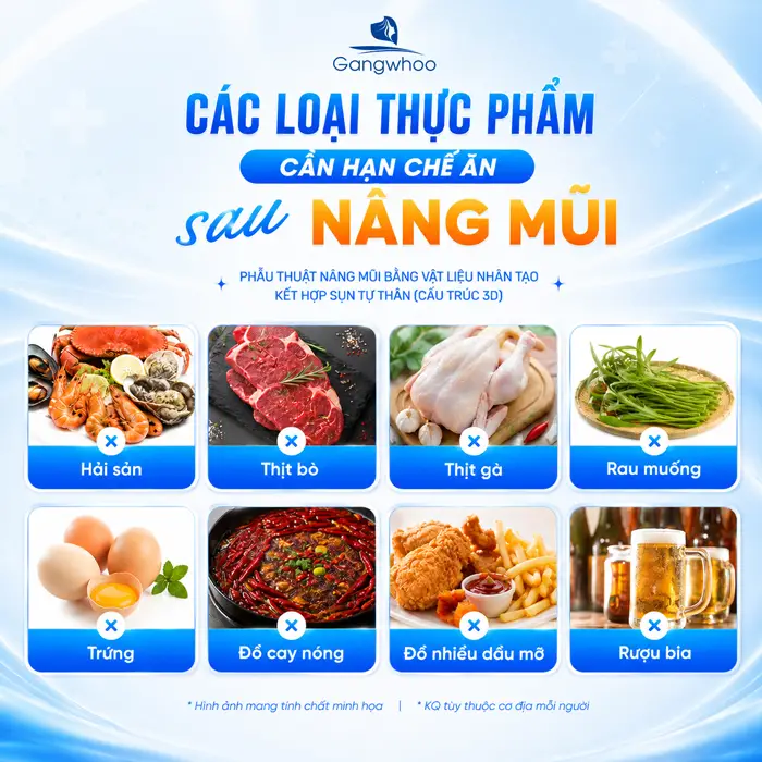 Nâng Mũi Ăn Thơm Được Không? 3 Lưu Ý Quan Trọng Từ Bác Sĩ
