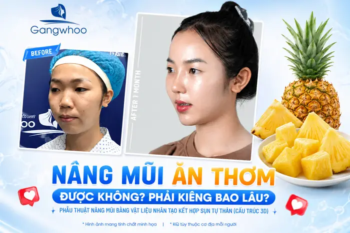 Nâng Mũi Ăn Thơm Được Không? 3 Lưu Ý Quan Trọng Từ Bác Sĩ