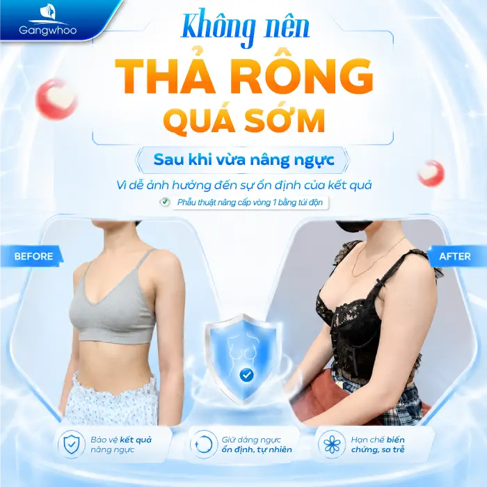 Nâng Ngực Bao Lâu Được Thả Rông? Tác Hại Khi Thả Rông Quá Sớm