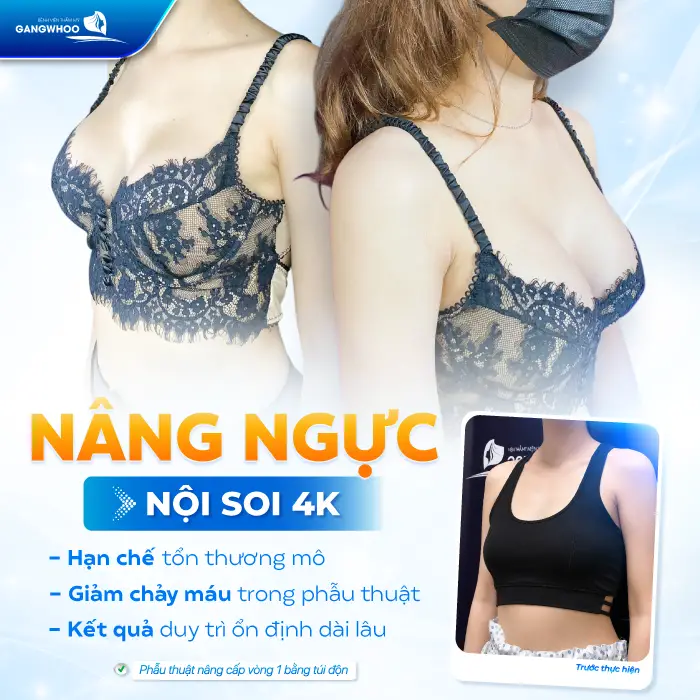 Nâng Ngực Bao Lâu Được Thả Rông? Tác Hại Khi Thả Rông Quá Sớm