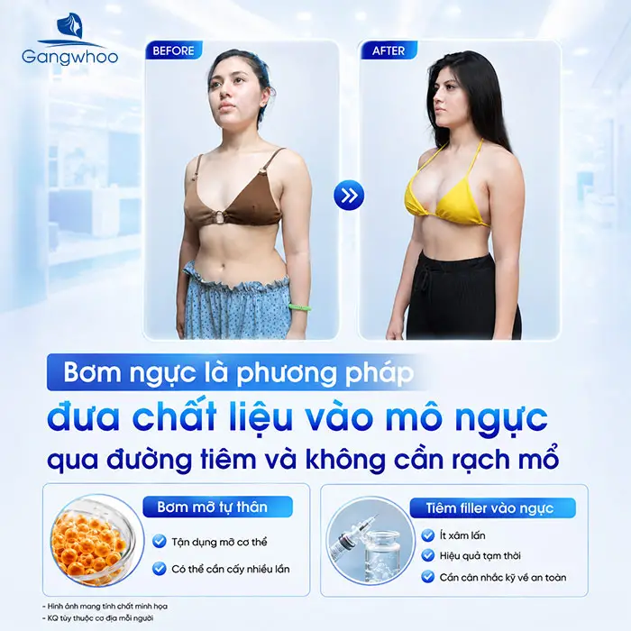 Bơm Ngực Khác Gì Nâng Ngực? Phân Biệt Chi Tiết Chuẩn Y Khoa