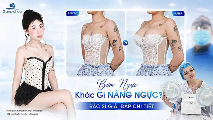 Bơm Ngực Khác Gì Nâng Ngực? Phân Biệt Chi Tiết Chuẩn Y Khoa