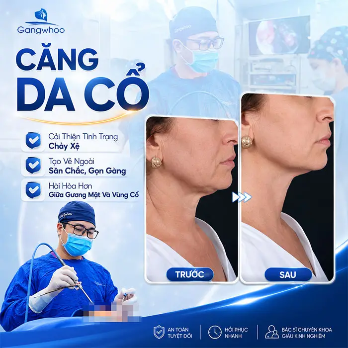 Căng Da Cổ Giá Bao Nhiêu? Bảng Giá Căng Da Cổ Năm 2026