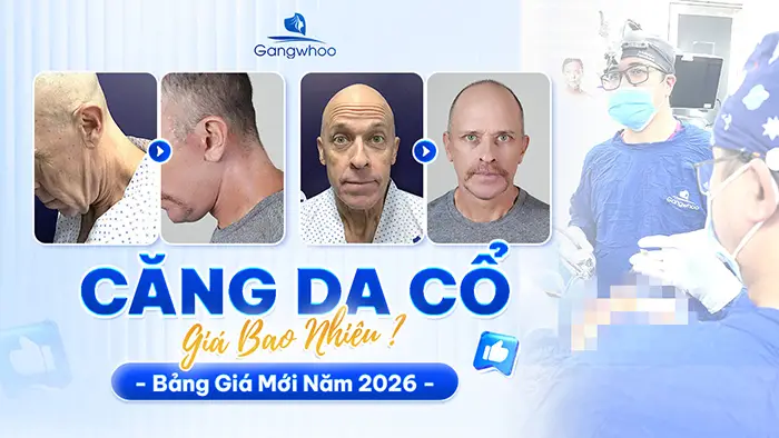 Căng Da Cổ Giá Bao Nhiêu? Bảng Giá Căng Da Cổ Năm 2026