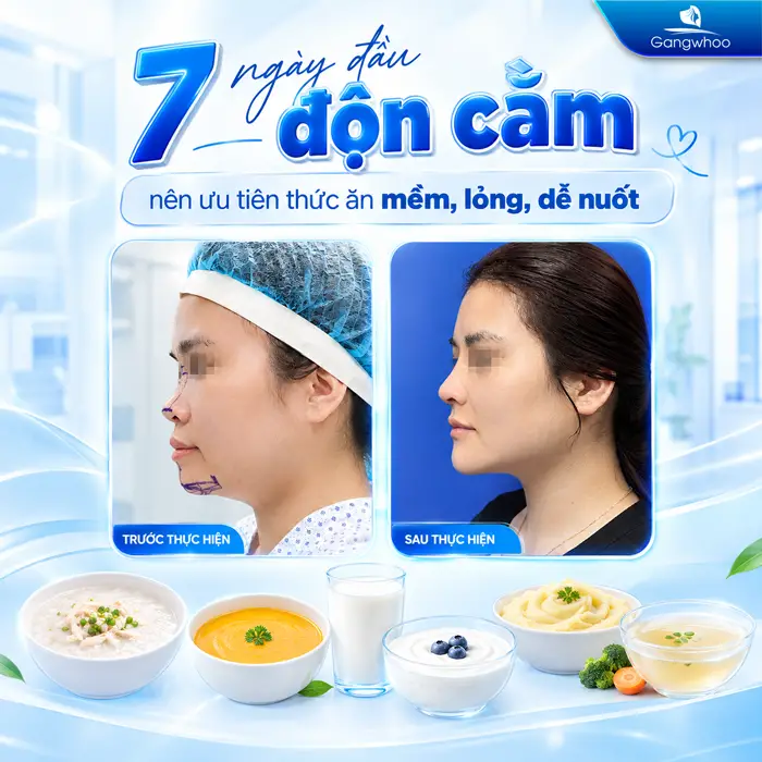 Độn Cằm Bao Lâu Cười Được? Những Yếu Tố Quyết Định