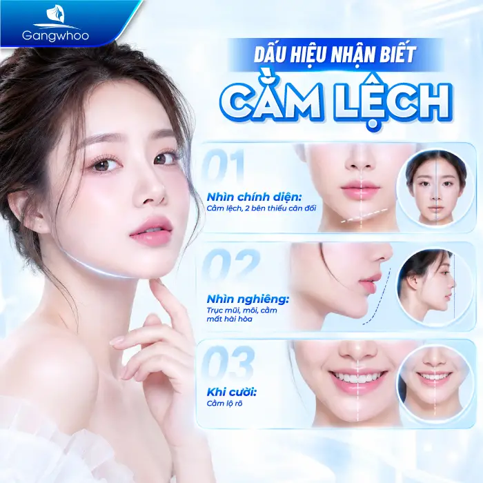 Độn Cằm Bị Lệch Phải Làm Sao? Nguyên Nhân Và Giải Pháp Khắc Phục Từ Chuyên Gia