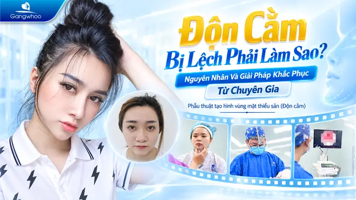 Độn Cằm Bị Lệch Phải Làm Sao? Nguyên Nhân Và Giải Pháp Khắc Phục Từ Chuyên Gia