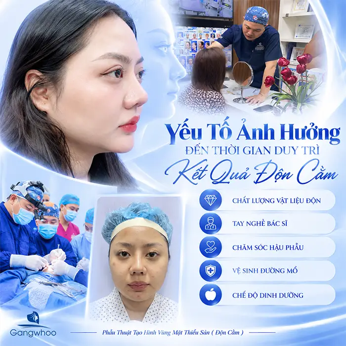 Độn Cằm Có Được Vĩnh Viễn Không? Góc Nhìn Toàn Diện Từ Chuyên Gia Thẩm Mỹ