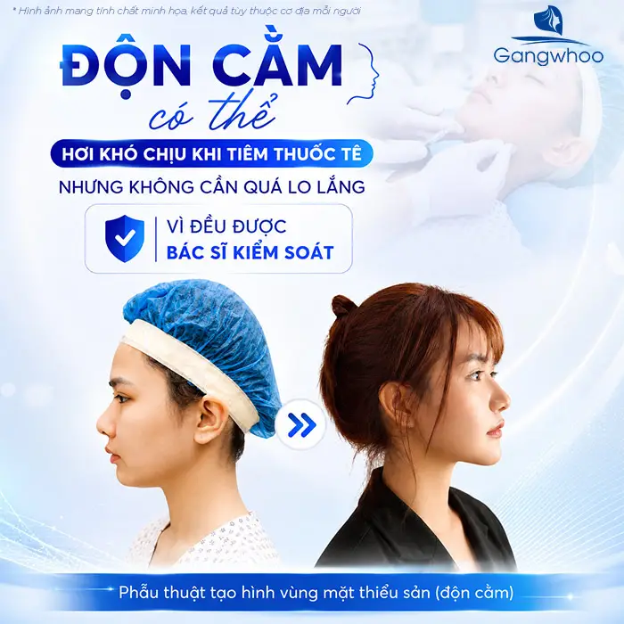 Độn Cằm Có Gây Mê Không? Giải Đáp Chuyên Môn