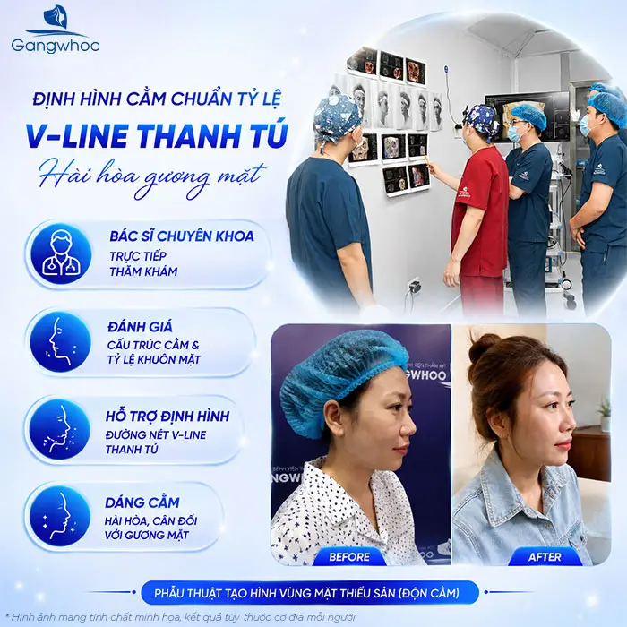 Độn Cằm Có Gây Mê Không? Giải Đáp Chuyên Môn