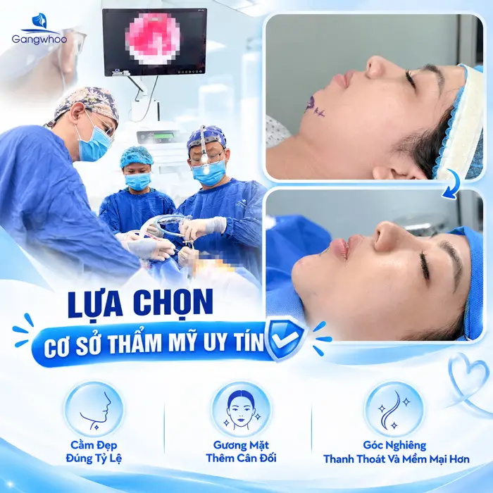 Độn Cằm Kiêng Ăn Gì? Hướng Dẫn Chi Tiết Chế Độ Dinh Dưỡng