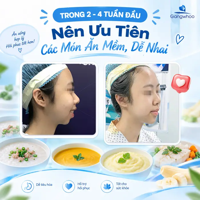 Độn Cằm Kiêng Ăn Gì? Hướng Dẫn Chi Tiết Chế Độ Dinh Dưỡng