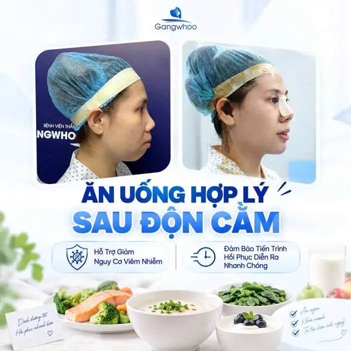 Độn Cằm Kiêng Ăn Gì? Hướng Dẫn Chi Tiết Chế Độ Dinh Dưỡng