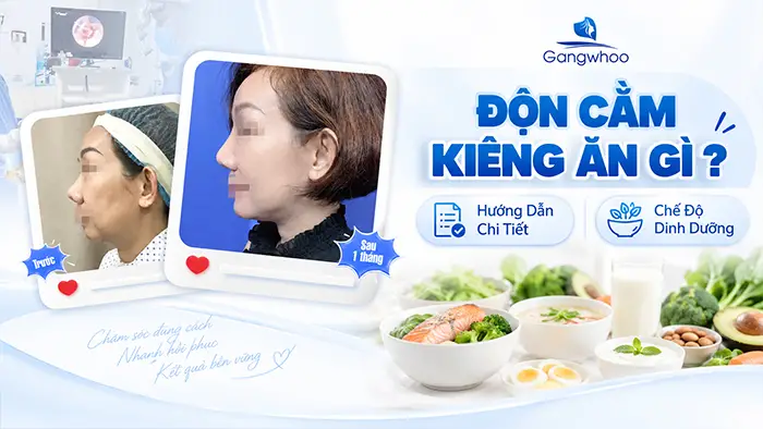 Độn Cằm Kiêng Ăn Gì? Hướng Dẫn Chi Tiết Chế Độ Dinh Dưỡng