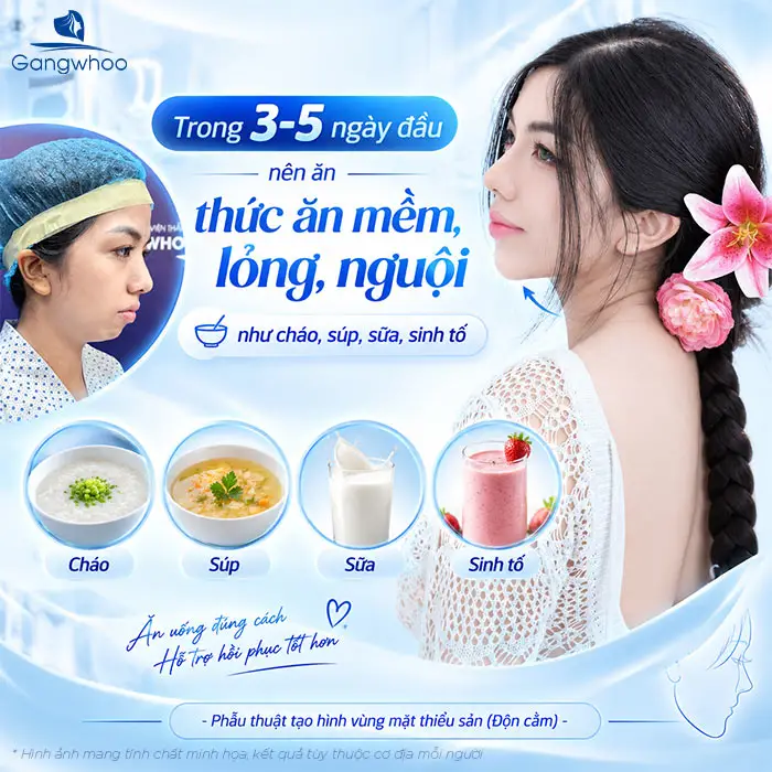 Độn Cằm Sụn Surgiform: Giải Pháp Tạo Dáng Cằm V-Line Chuẩn Y Khoa