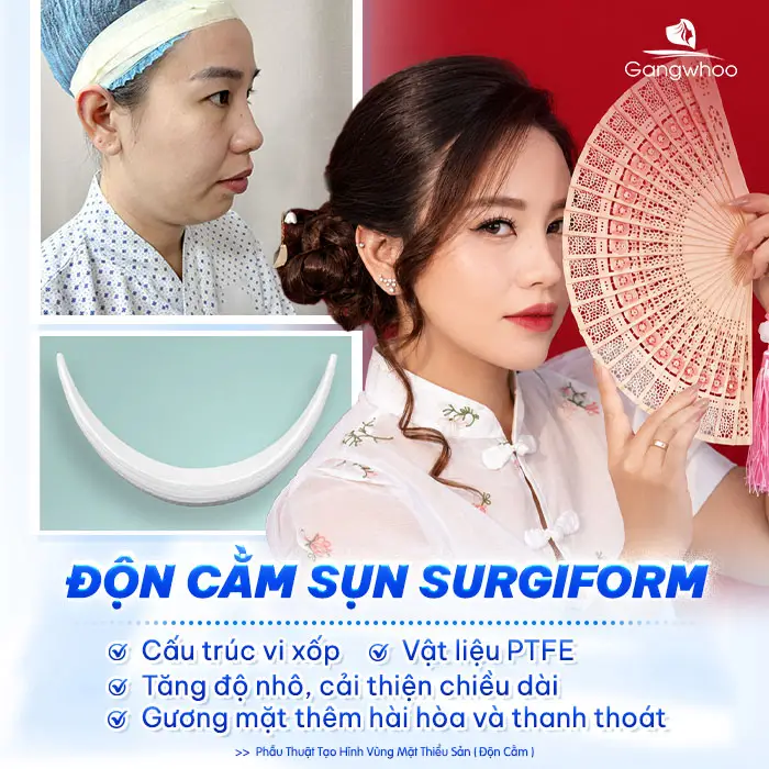 Độn Cằm Sụn Surgiform: Giải Pháp Tạo Dáng Cằm V-Line Chuẩn Y Khoa