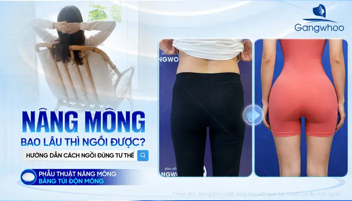 Nâng Mông Bao Lâu Thì Ngồi Được? Hướng Dẫn Cách Ngồi Đúng Tư Thế