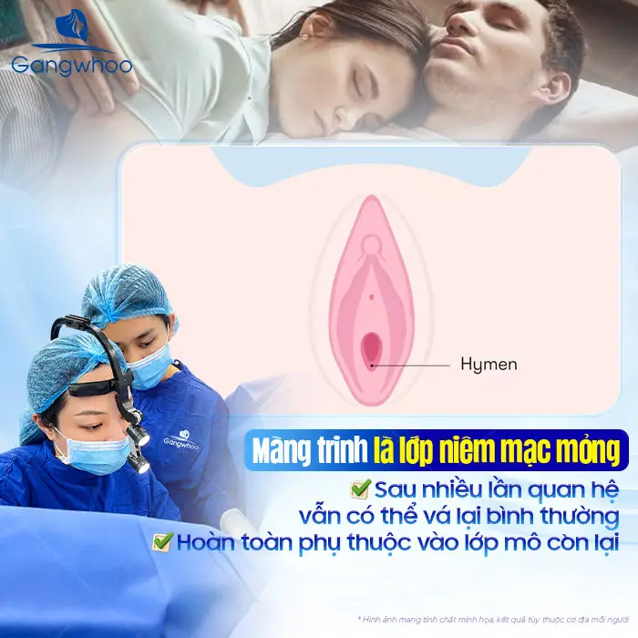 Vá Màng Trinh Được Không Khi Đã Quan Hệ Nhiều Lần? Giải Đáp Từ Chuyên Gia Gangwhoo