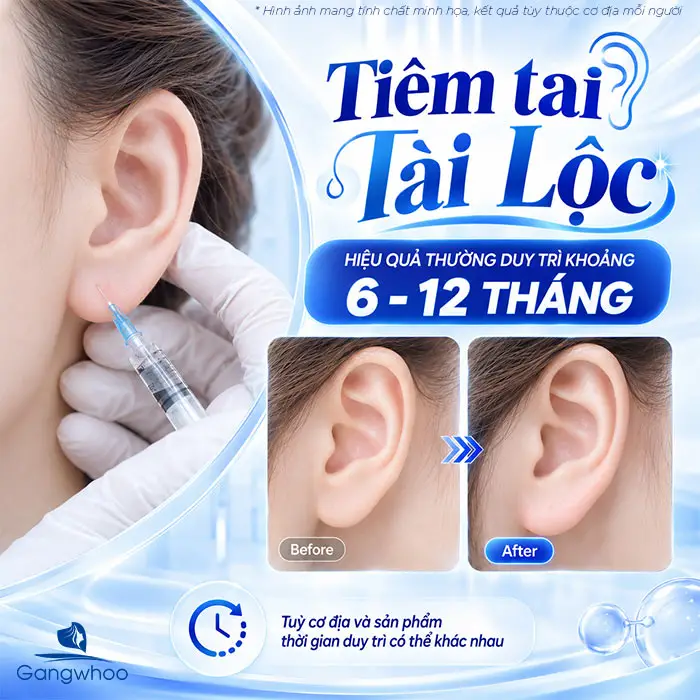 Tiêm Tai Tài Lộc Bao Nhiêu CC? Giải Đáp Chi Tiết Từ Bác Sĩ