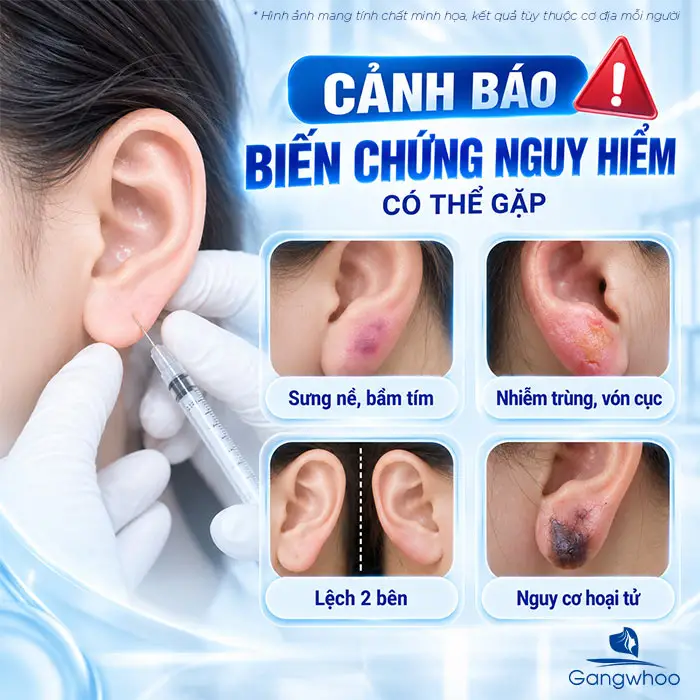Tiêm Tai Tài Lộc Bao Nhiêu CC? Giải Đáp Chi Tiết Từ Bác Sĩ