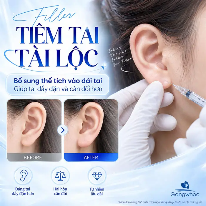 Tiêm Tai Tài Lộc Bao Nhiêu CC? Giải Đáp Chi Tiết Từ Bác Sĩ