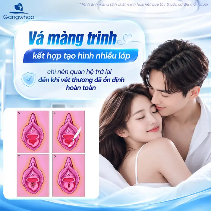 Vá Màng Trinh Bao Lâu Thì Quan Hệ Được? Giải Đáp Từ Chuyên Gia