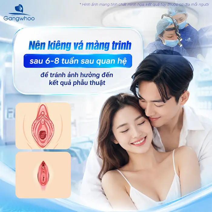 Vá Màng Trinh Bao Lâu Thì Quan Hệ Được? Giải Đáp Từ Chuyên Gia