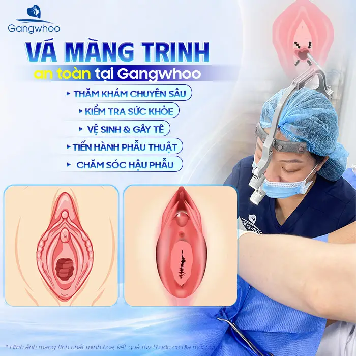 Vá Màng Trinh Có Nguy Hiểm Không? Những Lưu Ý Quan Trọng