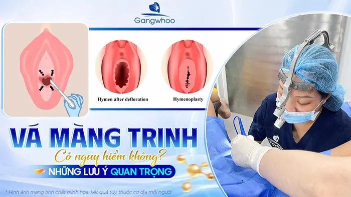 Vá Màng Trinh Có Nguy Hiểm Không? Những Lưu Ý Quan Trọng