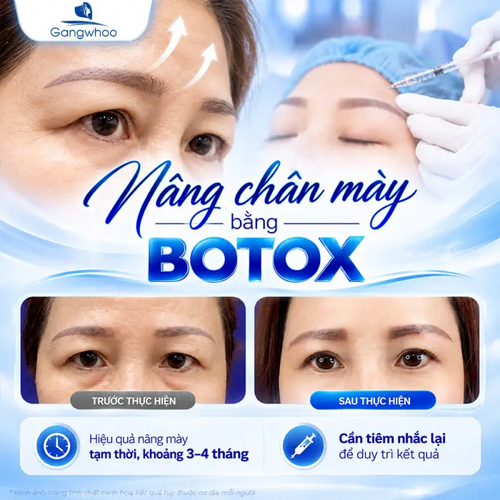 Nâng Cung Chân Mày Giữ Được Bao Lâu? Thời Gian Duy Trì Theo Từng Phương Pháp