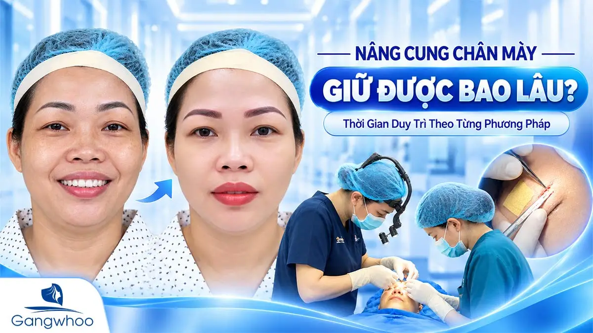 Nâng Cung Chân Mày Giữ Được Bao Lâu? Thời Gian Duy Trì Theo Từng Phương Pháp