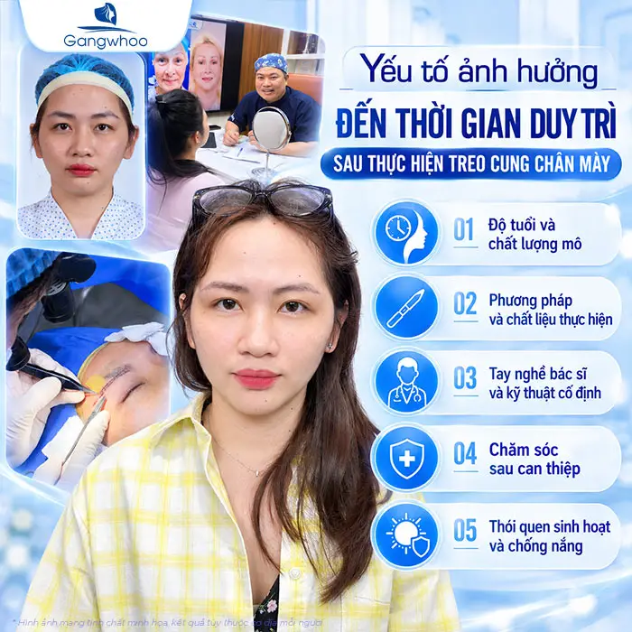 Nâng Cung Chân Mày Giữ Được Bao Lâu? Thời Gian Duy Trì Theo Từng Phương Pháp