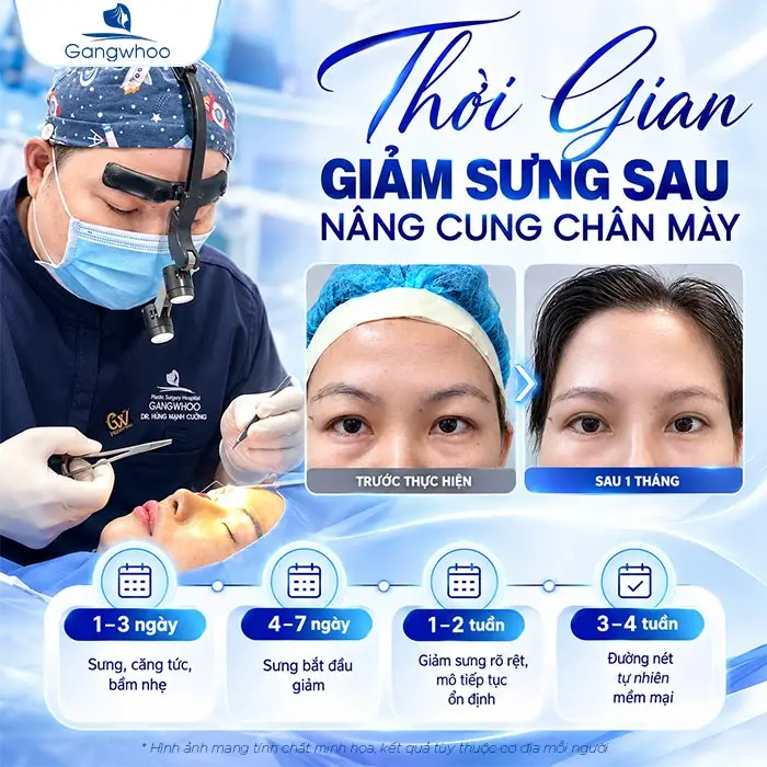 Nâng Cung Chân Mày Bao Lâu Thì Hết Sưng? Hướng Dẫn Chăm Sóc