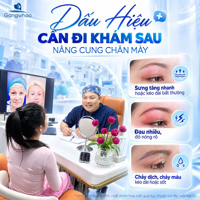 Nâng Cung Chân Mày Bao Lâu Thì Hết Sưng? Hướng Dẫn Chăm Sóc