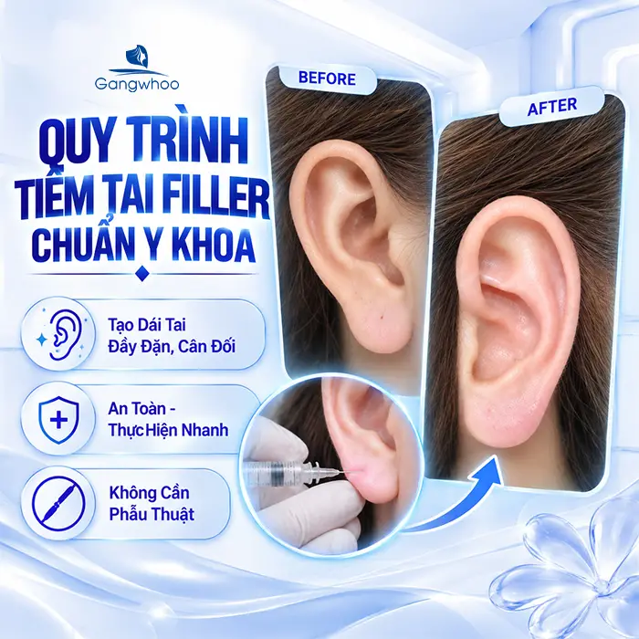 Tiêm Tai Tài Lộc Có Đau Không? Giải Đáp Từ Chuyên Gia Và Lưu Ý Cần Biết