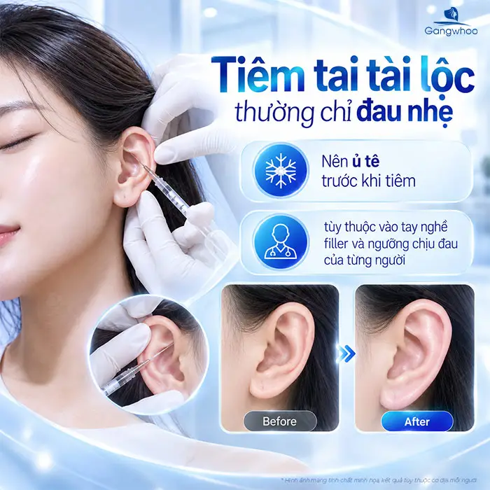 Tiêm Tai Tài Lộc Có Đau Không? Giải Đáp Từ Chuyên Gia Và Lưu Ý Cần Biết