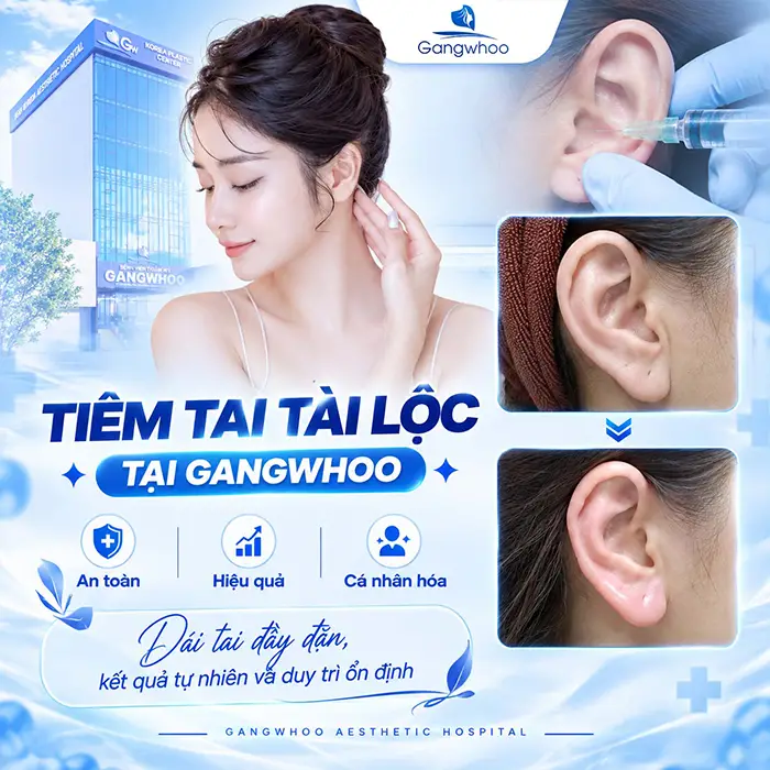 Tiêm Tai Tài Lộc Giá Bao Nhiêu? Bảng Gia Tiêm Filler Mới Nhất