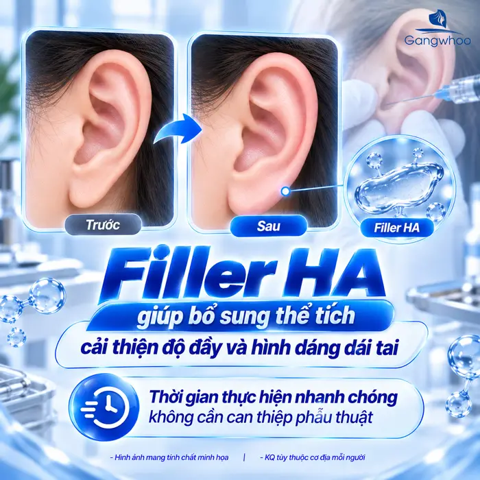 Tiêm Tai Tài Lộc Được Bao Lâu? Bác Sĩ Giải Đáp Chi Tiết