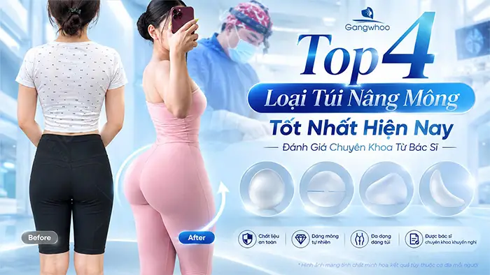 Top 4 Loại Túi Nâng Mông Tốt Nhất Hiện Nay – Đánh Giá Chuyên Khoa Từ Bác Sĩ