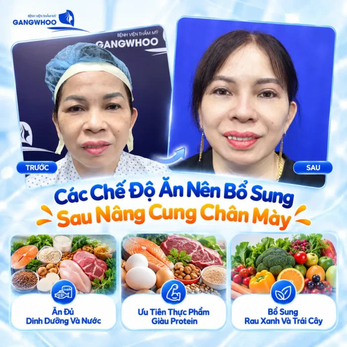 Nâng Cung Chân Mày Kiêng Ăn Gì? Danh Sách & Thời Gian Kiêng Chuẩn Y Khoa
