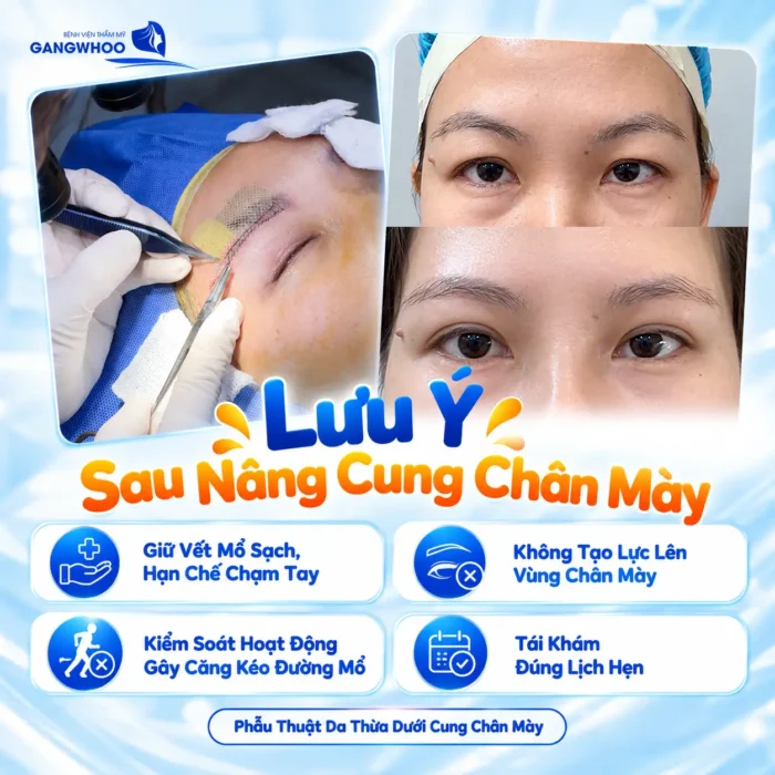 Nâng Cung Chân Mày Kiêng Ăn Gì? Danh Sách & Thời Gian Kiêng Chuẩn Y Khoa